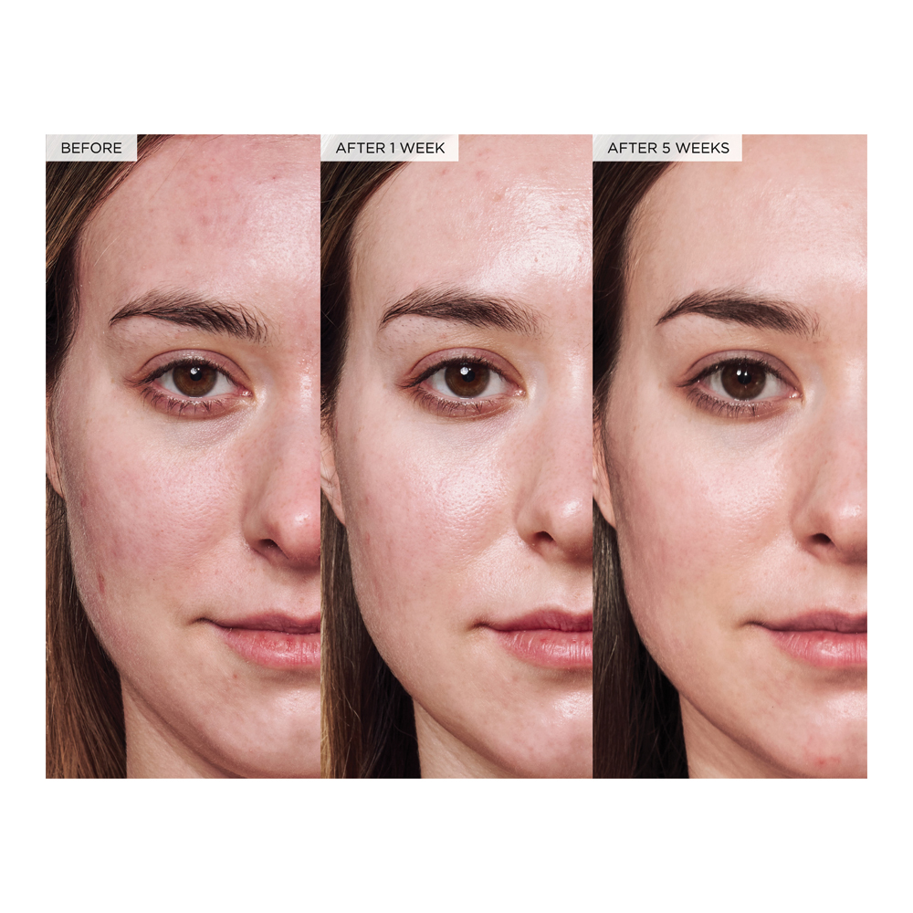 Avocado Ceramide Recovery Serum