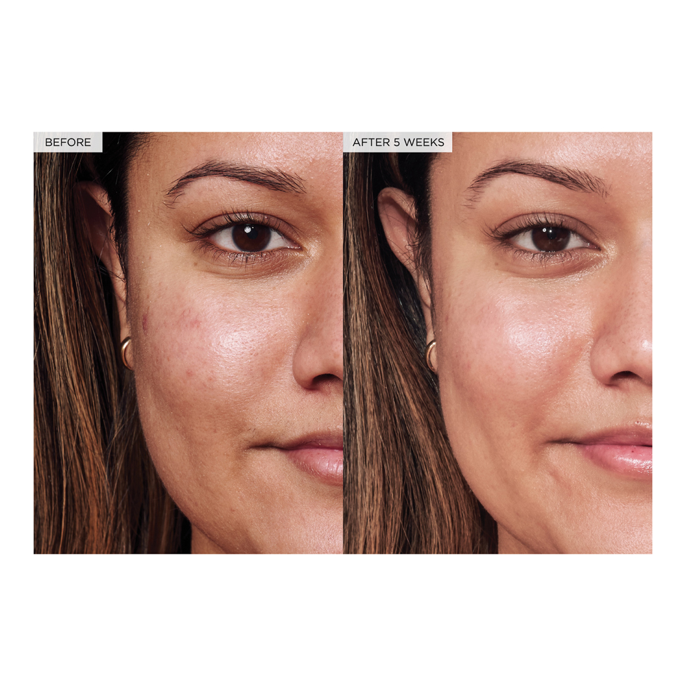 Avocado Ceramide Recovery Serum